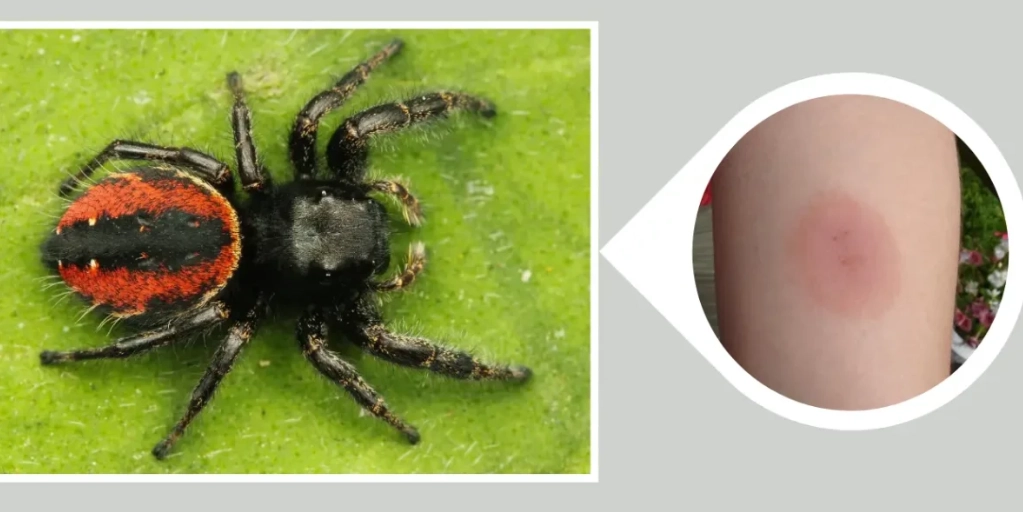are jumping spiders dangerous are jumping spiders dangerous